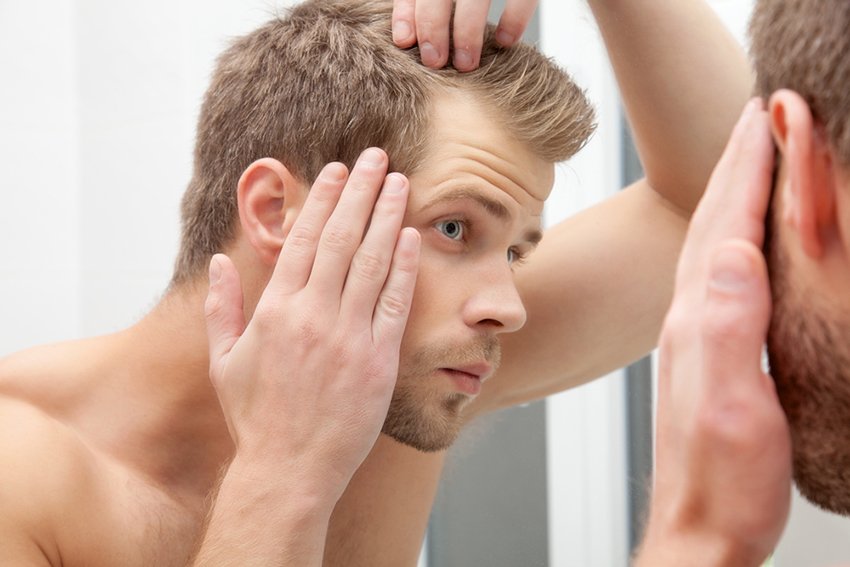 men's hair loss